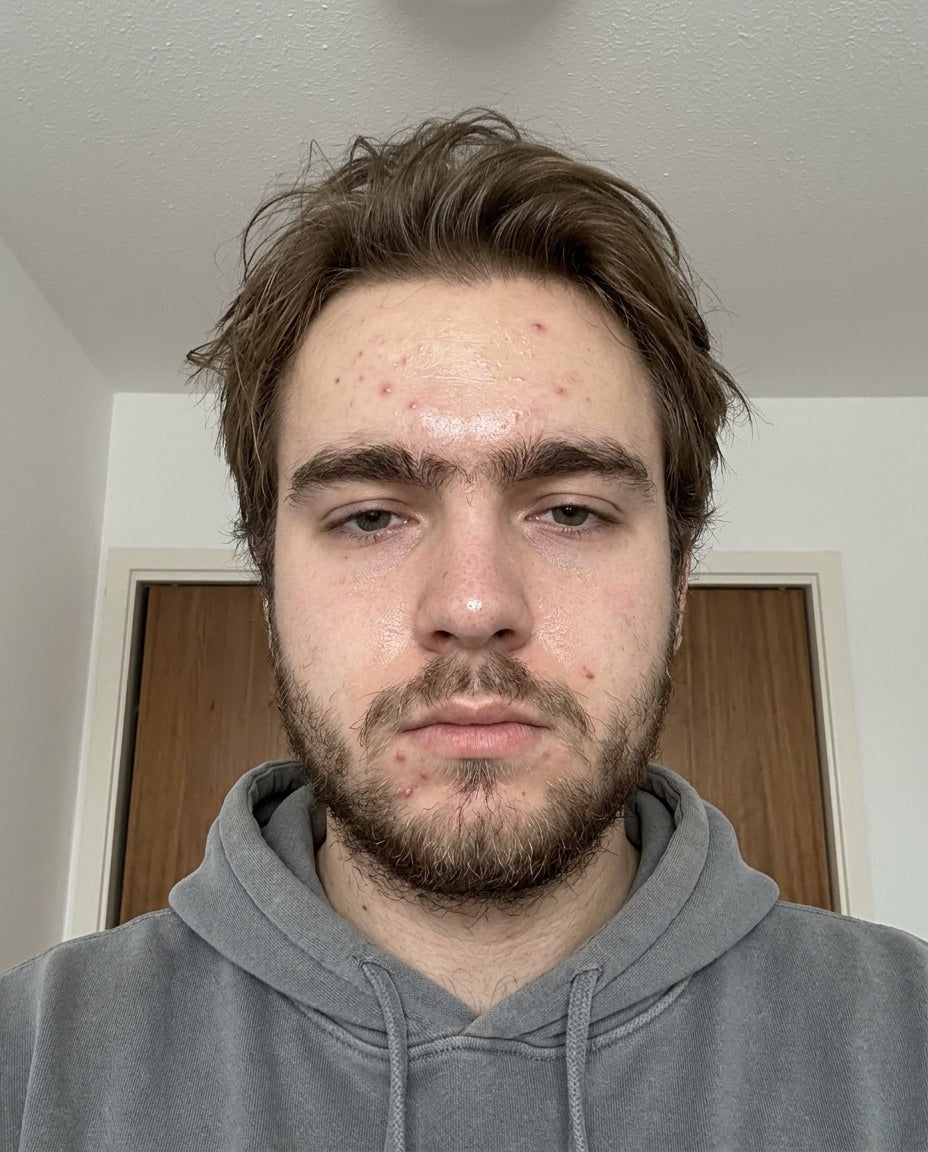Before illustration: shapeless hair, messy beard, dull skin